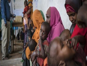 سوء التغذية يطارد أطفال الصومال